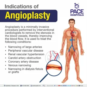 angioplasty+indications-640w